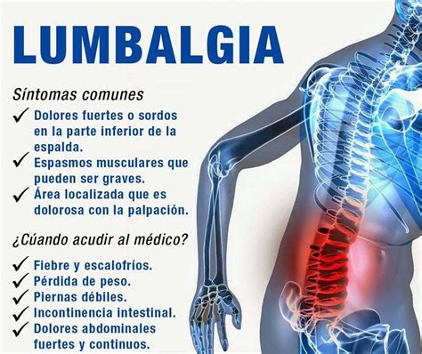 síntomas de lumbalgia-1